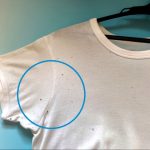 衣類に発生したカビの写真