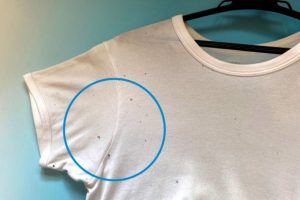 衣類に発生したカビの原因・効果的な落とし方・予防法を詳しく解説