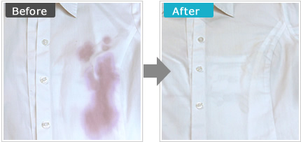before after